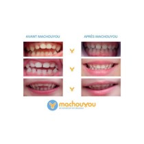 Machouyou Dispositif 1eres dents couleur - Orange